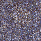 Immunohistochemical staining of human tonsil shows strong granular cytoplasmic positivity in non-germinal and germinal center cells.
