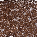 Anti-SECISBP2L Antibody