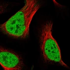 Immunofluorescent staining of human cell line U-2 OS shows localization to nucleoplasm.