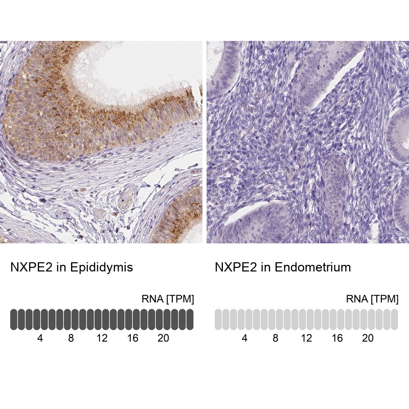 Anti-NXPE2 Antibody