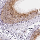 Immunohistochemical staining of human epididymis shows high expression.