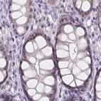 Immunohistochemical staining of human colon using Anti-NXPE2 antibody HPA039876.