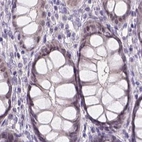 Immunohistochemical staining of human colon using Anti-NXPE2 antibody HPA039876.