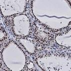 Anti-CWC15 Antibody