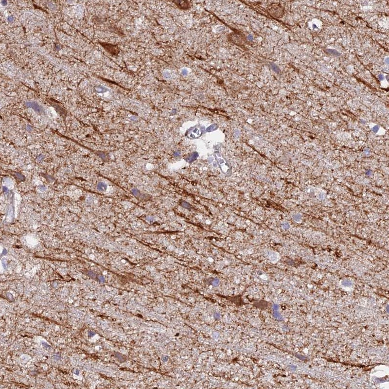 Anti-NEDD4 Antibody