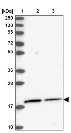 Lane 1: Marker [kDa] 250, 130, 95, 72, 55, 36, 28, 17, 10_br/_Lane 2: Human cell line RT-4_br/_Lane 3: Human cell line U-251MG sp