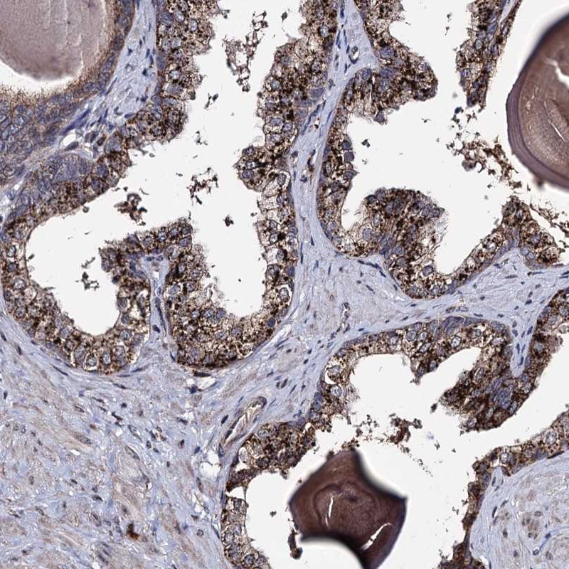 Anti-MICALCL Antibody