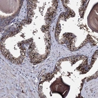 Anti-MICALCL Antibody