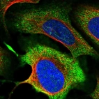 Immunofluorescent staining of human cell line U-2 OS shows localization to cytosol.