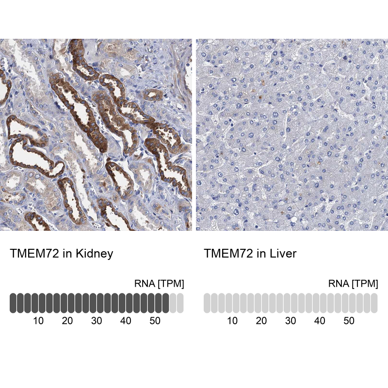 Anti-TMEM72 Antibody