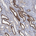 Immunohistochemical staining of human Kidney shows strong membranous and cytoplasmic positivity in cells in distal tubules.