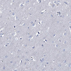 Immunohistochemical staining of human Cerebral cortex shows no positivity in neurons as expected.