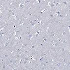 Immunohistochemical staining of human Cerebral cortex shows no positivity in neurons as expected.