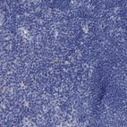 Immunohistochemical staining of human Lymph node shows no positivity in non-germinal center cells as expected.