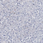 Immunohistochemical staining of human Liver shows no positivity in hepatocytes as expected.