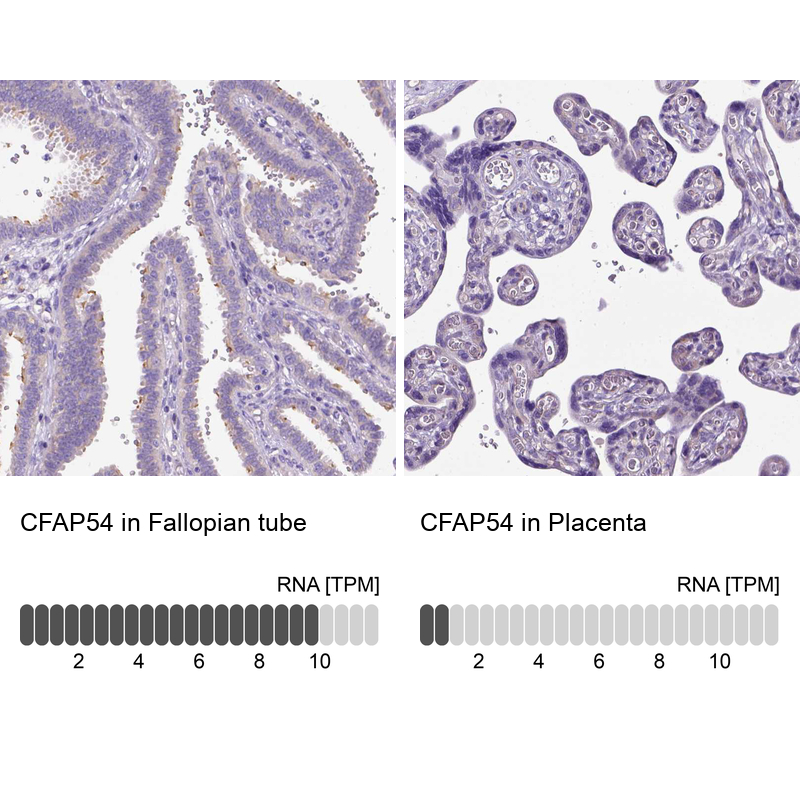 Anti-CFAP54 Antibody