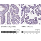 Anti-CFAP54 Antibody