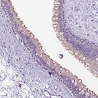 Immunohistochemical staining of human nasopharynx shows strong positivity in cilia in glandular cells.