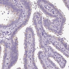 Immunohistochemical staining of human fallopian tube shows moderate positivity in cilia in glandular cells.