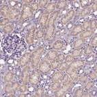 Immunohistochemical staining of human kidney shows moderate cytoplasmic positivity in cells in tubules.