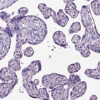 Immunohistochemical staining of human placenta shows no positivity in trophoblastic cells as expected.