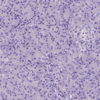 Anti-CFAP54 Antibody