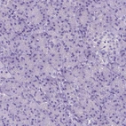 Immunohistochemical staining of human pancreas shows no positivity in exocrine glandular cells as expected.