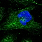 Immunofluorescent staining of human cell line U-2 OS shows localization to cytosol & microtubules.