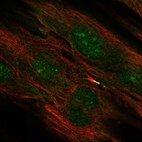 Anti-TMEM117 Antibody