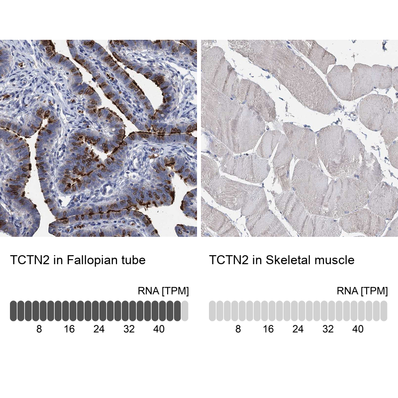 Anti-TCTN2 Antibody