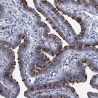 Immunohistochemical staining of human fallopian tube shows high expression.