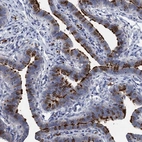 Immunohistochemical staining of human fallopian tube shows high expression.