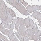 Immunohistochemical staining of human skeletal muscle shows low expression as expected.