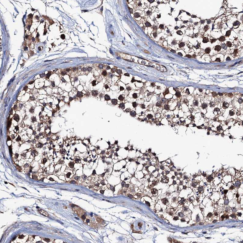 Anti-TRMT112 Antibody
