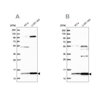 Western blot analysis using Anti-TRMT112 antibody HPA039901 (A) shows similar pattern to independent antibody HPA040006 (B).