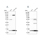 Western blot analysis using Anti-TRMT112 antibody HPA039901 (A) shows similar pattern to independent antibody HPA040006 (B).