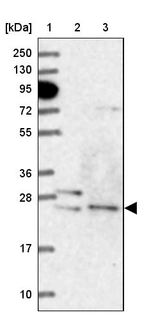 Lane 1: Marker [kDa] 250, 130, 95, 72, 55, 36, 28, 17, 10_br/_Lane 2: Human cell line RT-4_br/_Lane 3: Human cell line U-251MG sp