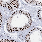 Immunohistochemical staining of human testis shows strong nuclear positivity in cells in seminiferous ducts.