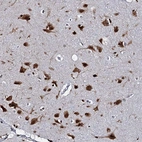 Immunohistochemical staining of human cerebral cortex shows strong nuclear positivity in neurons.