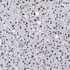 Immunohistochemical staining of human liver shows strong nuclear positivity in hepatocytes.