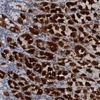 Immunohistochemical staining of human stomach shows strong cytoplasmic positivity in glandular cells.