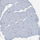 Immunohistochemical staining of human skeletal muscle shows no cytoplasmic positivity in myocytes as expected.