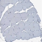 Immunohistochemical staining of human skeletal muscle shows no cytoplasmic positivity in myocytes as expected.