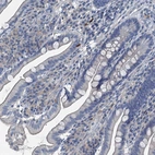 Immunohistochemical staining of human small intestine shows no cytoplasmic positivity in glandular cells as expected.