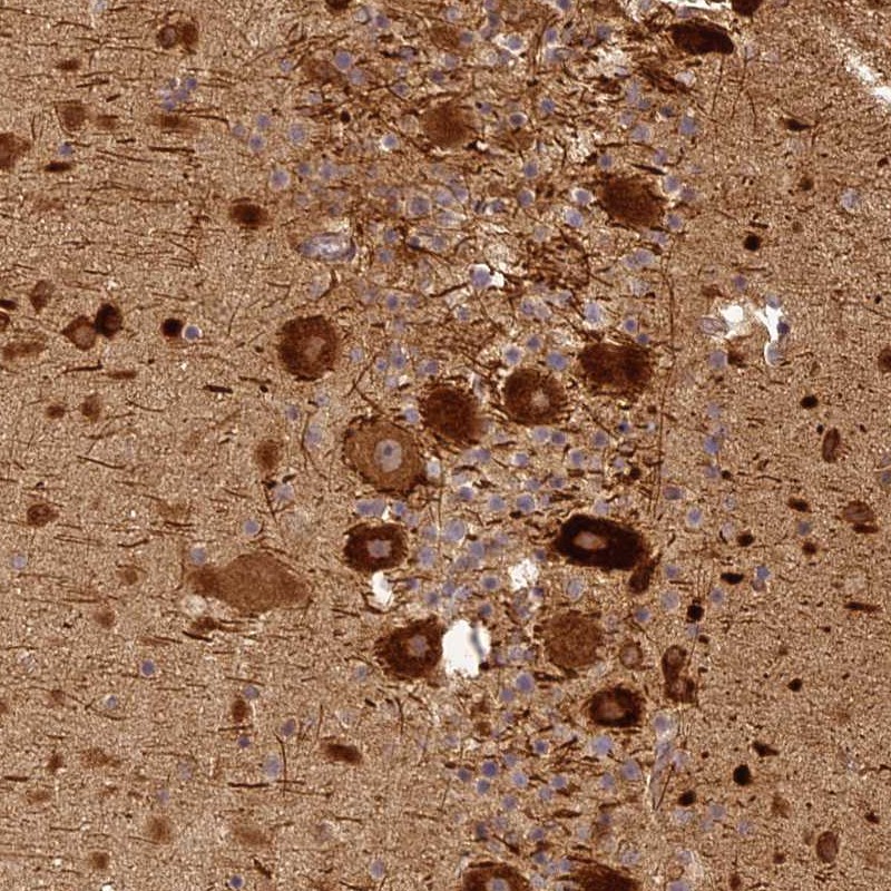 Anti-BCDIN3D Antibody