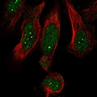 Immunofluorescent staining of human cell line U-251 MG shows localization to nucleus & nuclear bodies.