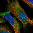 Immunofluorescent staining of human cell line U-2 OS shows localization to cytosol.