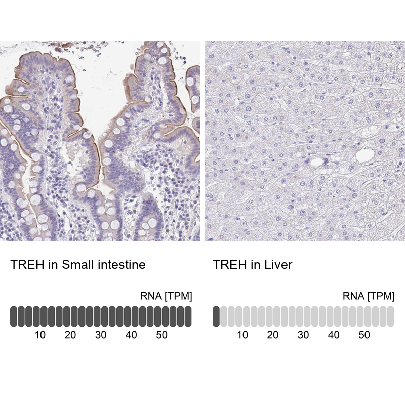 Anti-TREH Antibody