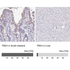 Anti-TREH Antibody