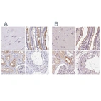 Immunohistochemical staining of human cerebral cortex, duodenum, kidney and testis using Anti-TREH antibody HPA039913 (A) shows similar protein distribution across tissues to independent antibody HPA042045 (B).
